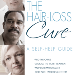Hair Loss Book